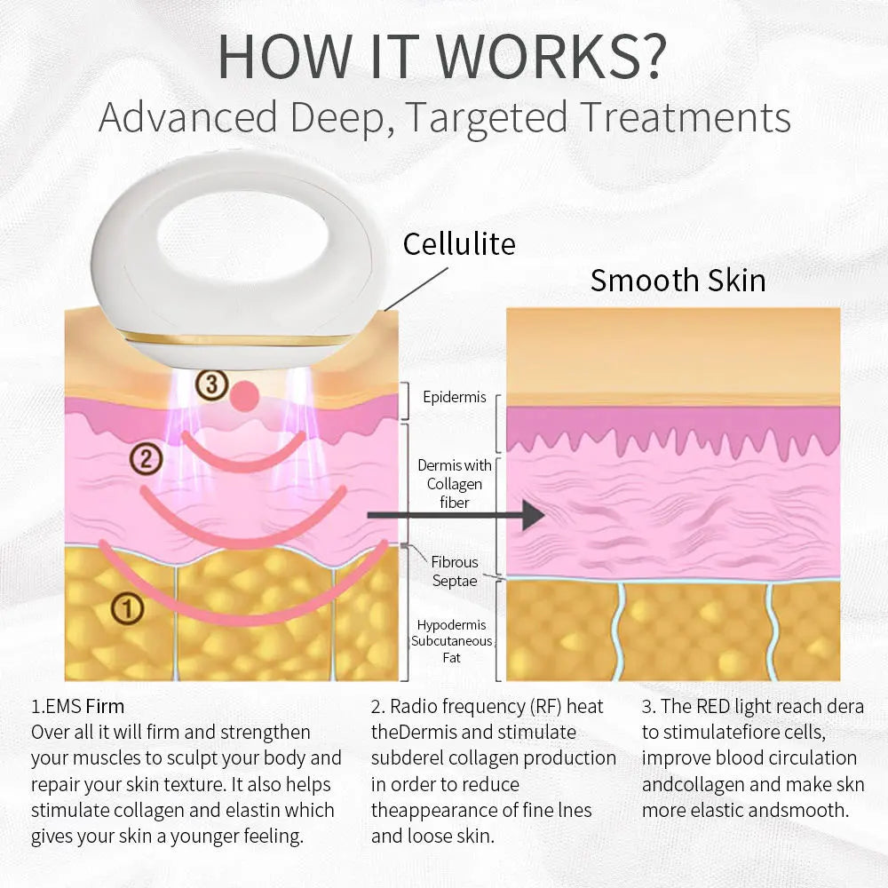 Handheld Cellulite Remover Sculptor Body Massage All Over Body Cellulite Fat Iron Sooth Refresh Anti-wrinkle
