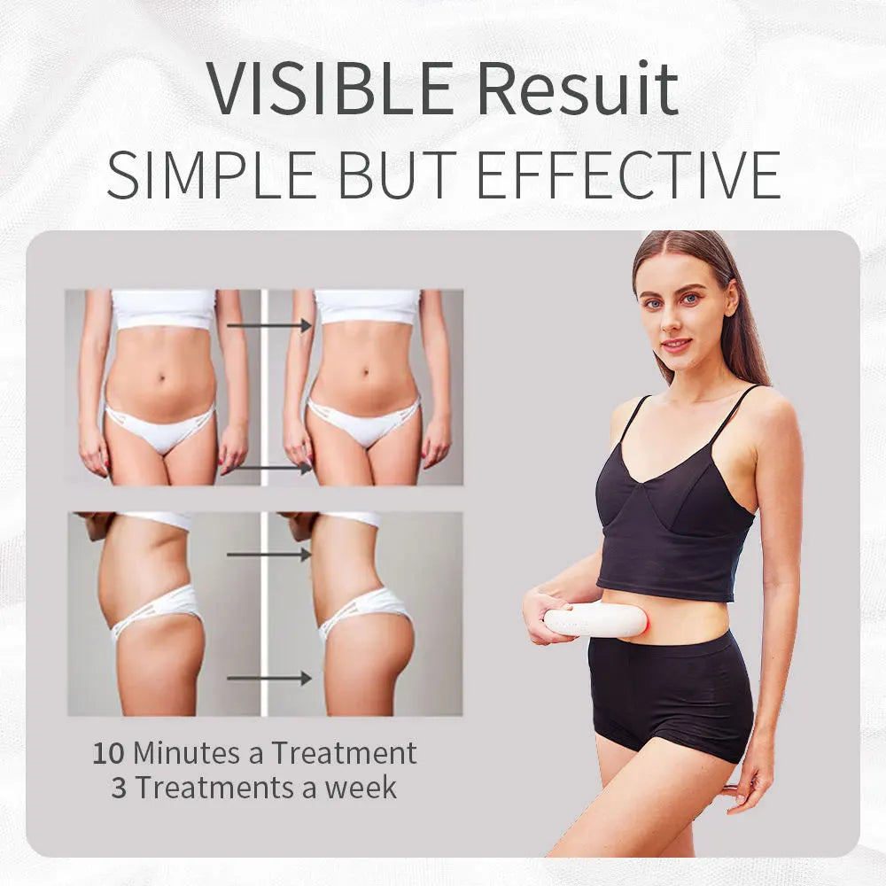 Handheld Cellulite Remover Sculptor Body Massage All Over Body Cellulite Fat Iron Sooth Refresh Anti-wrinkle