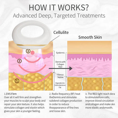 Handheld Cellulite Remover Sculptor Body Massage All Over Body Cellulite Fat Iron Sooth Refresh Anti-wrinkle