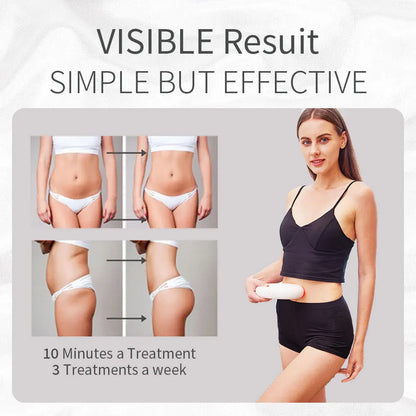 Handheld Cellulite Remover Sculptor Body Massage All Over Body Cellulite Fat Iron Sooth Refresh Anti-wrinkle